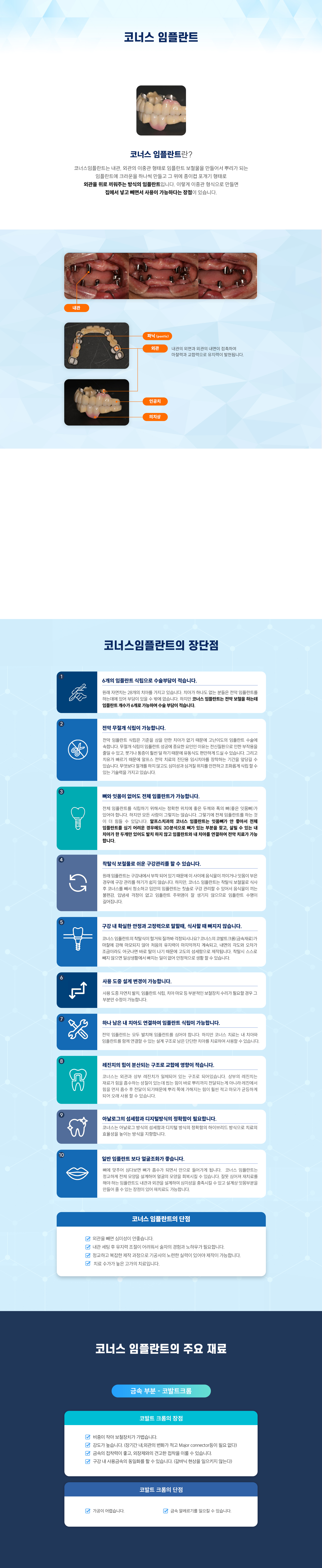 코너스 임플란트