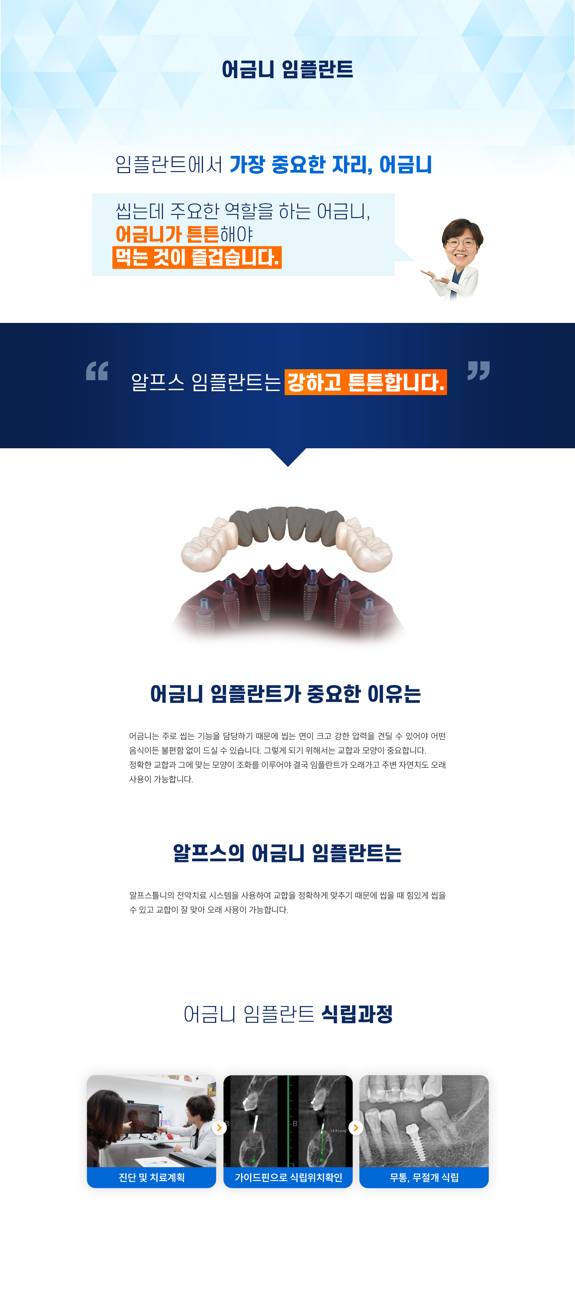 어금니 임플란트